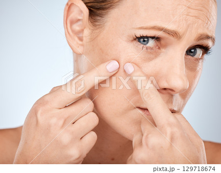 Health, skincare and woman squeeze acne in face with studio background. Skin care, morning facial and lady with flaws, blemish and imperfection pop pimple or blackhead with fingers and hands. Health, skincare and woman squeeze acne in face with studio background. Skin care, morning facial and lady with flaws, blemish and imperfection pop pimple or blackhead with fingers and hands. 129718674