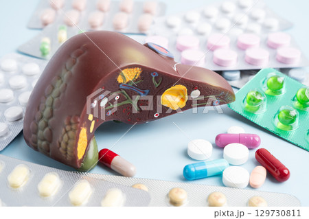 Liver model with pill drug treatment, Cirrhosis, Liver cancer, fatty liver. 129730811
