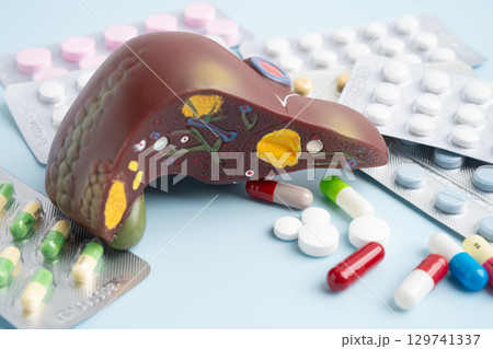 Liver model with pill drug treatment, Cirrhosis, Liver cancer, fatty liver. Liver model with pill drug treatment, Cirrhosis, Liver cancer, fatty liver. 129741337