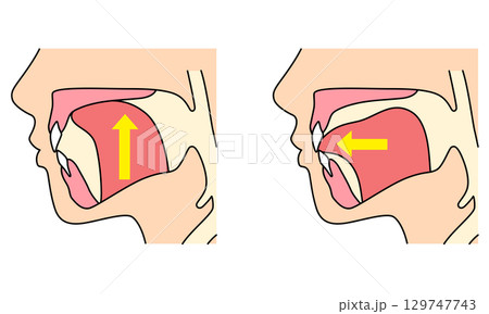 正しいミューイングの方法　適正な舌の位置と誤った舌の位置 129747743