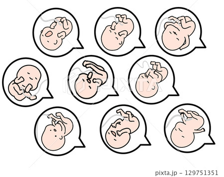 いろいろな表情の胎児セット いろいろな表情の胎児セット 129751351