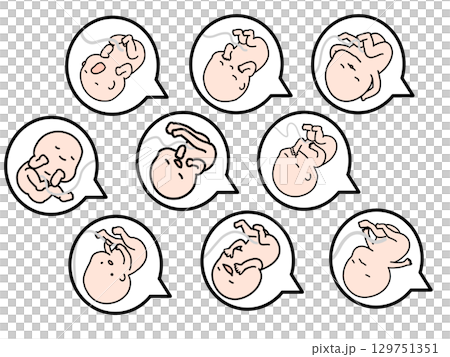 胎兒有各種面部表情 胎兒有各種面部表情 129751351