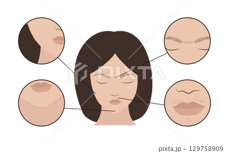 Woman face showing areas for epilation and hair removal 129758909