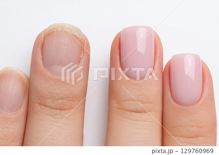 Comparison of well-maintained and neglected nails showcasing manicure and natural nail care. concept of beauty, personal grooming, nail health 129760969