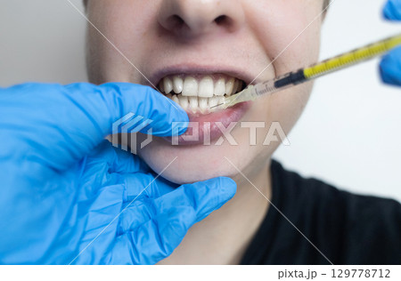 Dental injection for gum recession treatment. Exposure of tooth root and gum treatment. Regenerative therapy 129778712