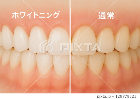 ホワイトニング　クリーニング　審美歯科　 129779523