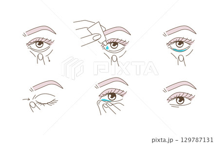 Woman Using Eye Drops Bottle. Instruction how to Correctly Applying Eyedrops. Ophthalmology Healthcare against Redness, Allergy, Dry Eyes 129787131