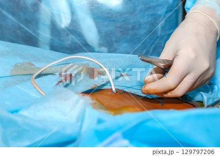 Surgeon performing a delicate surgical procedure in a hospital operating room 129797206