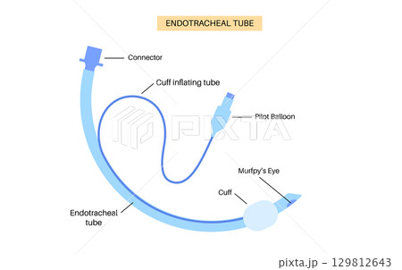 endotracheal intubation tube endotracheal intubation tube 129812643