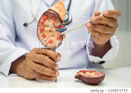 Chronic kidney disease, doctor with model for treatment urinary system, urology, Estimated glomerular filtration rate eGFR. Chronic kidney disease, doctor with model for treatment urinary system, urology, Estimated glomerular filtration rate eGFR. 129873755