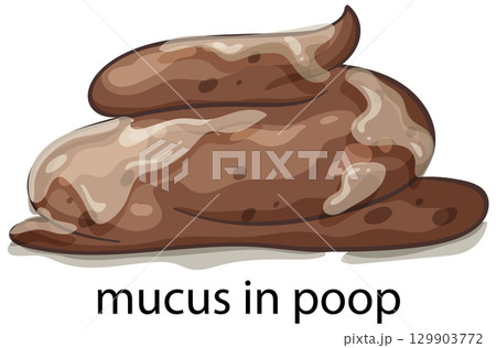 Illustration of Mucus in Stool 129903772