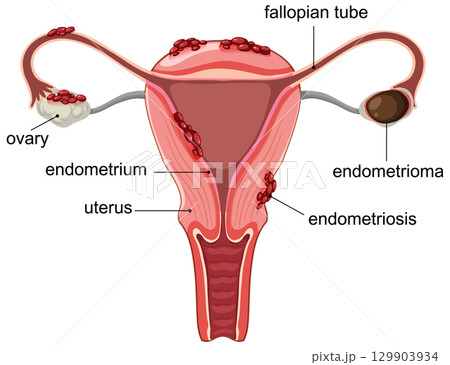 Detailed Medical Illustration of Female Reproductive System 129903934