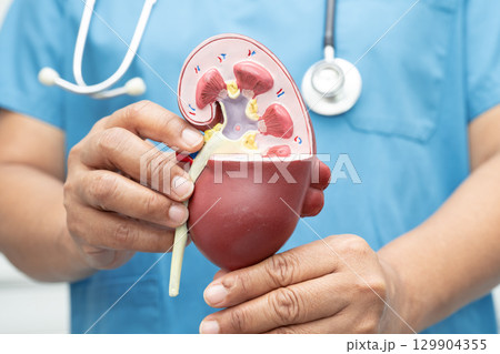 Kidney disease, Chronic kidney disease ckd, Doctor hold model to study and treat in hospital. 129904355