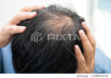 Bald in the middle head and begin no loss hair glabrous of mature Asian business smart active office man. 129904356