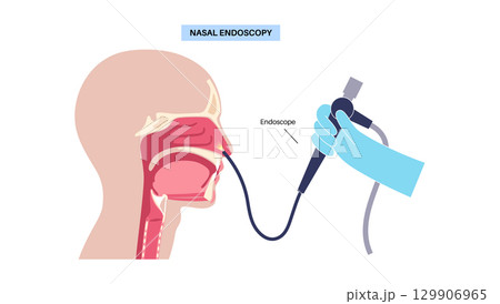 Nasal endoscopy poster Nasal endoscopy poster 129906965