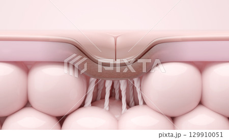 ニキビ跡(クレーター)の原因となる瘢痕組織の皮膚断面CG ニキビ跡(クレーター)の原因となる瘢痕組織の皮膚断面CG 129910051