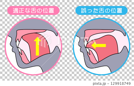 How to mew properly: correct and incorrect tongue position 129918749