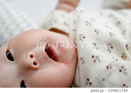 よだれかぶれで口周りが赤くなった5ヶ月の女の子の赤ちゃん よだれかぶれで口周りが赤くなった5ヶ月の女の子の赤ちゃん 129921784