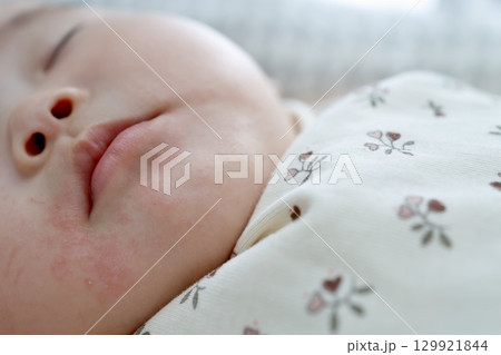 生後5ヶ月の赤ちゃんのよだれかぶれと赤みの口元クローズアップ写真 129921844