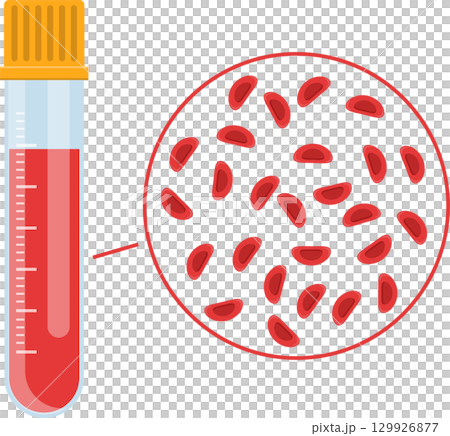 Blood sample in tube with magnified view of red blood cells for medical analysis and diagnosis. 129926877