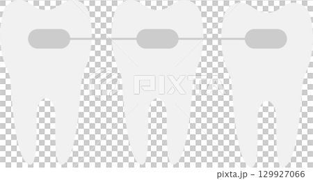 Three teeth with dental braces, aligned on a white background, representing orthodontics. 129927066