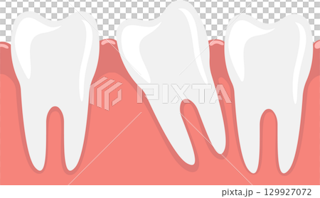 Misaligned teeth, also known as malocclusion, can cause problems with chewing, speaking, and cleaning. 129927072