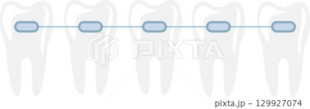 Illustration of five teeth aligned with dental braces, symbolizing orthodontic treatment. Illustration of five teeth aligned with dental braces, symbolizing orthodontic treatment. 129927074