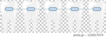 Illustration of five teeth aligned with dental braces, symbolizing orthodontic treatment. Illustration of five teeth aligned with dental braces, symbolizing orthodontic treatment. 129927074
