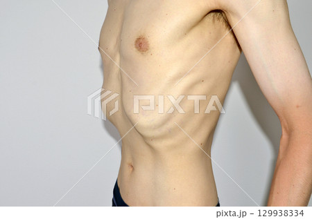 ガリガリの裸の男性の上半身 129938334