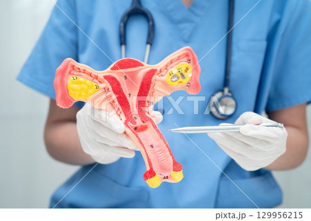 Uterus, doctor holding human anatomy model for study diagnosis and treatment in hospital. Uterus, doctor holding human anatomy model for study diagnosis and treatment in hospital. 129956215