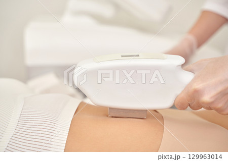 Female receiving laser hair removal on abdomen in spa treatment session Female receiving laser hair removal on abdomen in spa treatment session 129963014