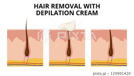Depilation cream dissolving hair on skin Depilation cream dissolving hair on skin 129991420