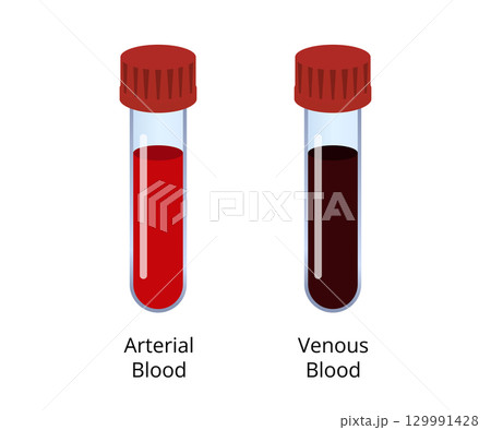 Comparing arterial and venous blood samples in test tubes 129991428