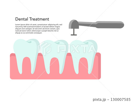 Dental Treatment flat vector illustration stock illustration Dental Treatment flat vector illustration stock illustration 130007585