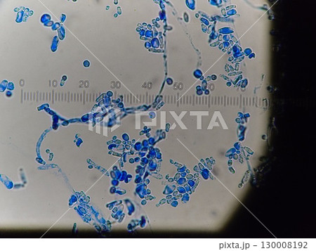下水処理施設の微生物 下水処理施設の微生物 130008192