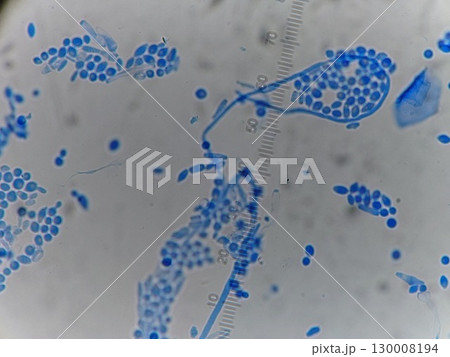 下水道の中に含まれていたカビの顕微鏡観察 130008194