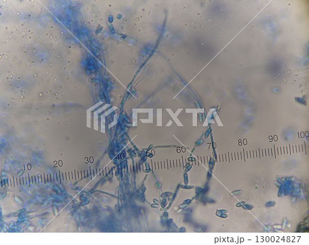 下水中に存在しているカビの染色写真 下水中に存在しているカビの染色写真 130024827