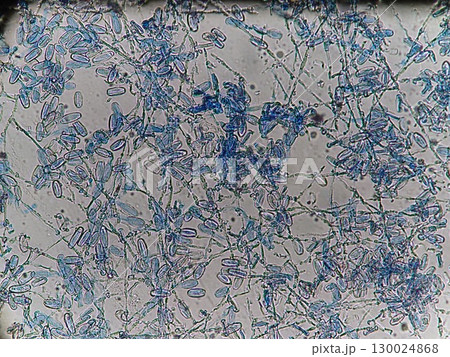 うどん粉病の菌糸が広がる様子 130024868