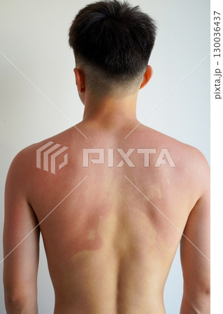 日焼けした若い男性の背中	 130036437