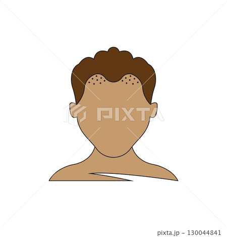 Hair loss color icon. Balding. Declining testosterone. Alopecia, baldness. Men aging. vector Hair loss color icon. Balding. Declining testosterone. Alopecia, baldness. Men aging. vector 130044841