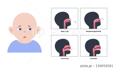 swab medical procedure swab medical procedure 130058581