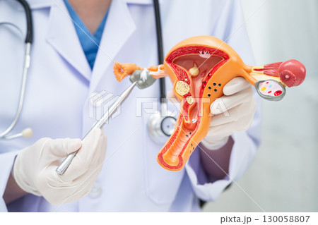 Uterus, doctor holding human anatomy model for study diagnosis and treatment in hospital. Uterus, doctor holding human anatomy model for study diagnosis and treatment in hospital. 130058807