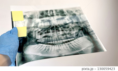 Dentist examines x rays of human teeth for proper treatment and diagnosis in modern dental clinic, professional dentistry healthcare and oral health care concept with stomatology radiography check up Dentist examines x rays of human teeth for proper treatment and diagnosis in modern dental clinic, professional dentistry healthcare and oral health care concept with stomatology radiography check up 130059423