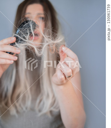 Upset young woman worried about brittle hair holding hairbrush with strands showing early signs of alopecia 130061739