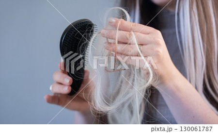 Young woman with brittle hair holding hairbrush with damaged strands showing early signs of alopecia and hair breakage Young woman with brittle hair holding hairbrush with damaged strands showing early signs of alopecia and hair breakage 130061787