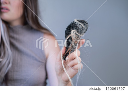 Frustrated woman holding hairbrush with fallen strands showing signs of hair loss and damaged brittle hair 130061797
