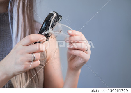 Worried woman showing damaged hair on brush hair breakage and early stage hair loss problem 130061799