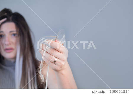 Young woman showing effects of severe hair loss after brushing strands in beauty or hair care context Young woman showing effects of severe hair loss after brushing strands in beauty or hair care context 130061834