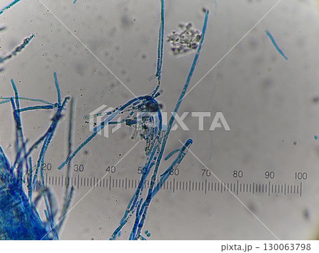 コットンブルーで染色した菌糸の様子 コットンブルーで染色した菌糸の様子 130063798