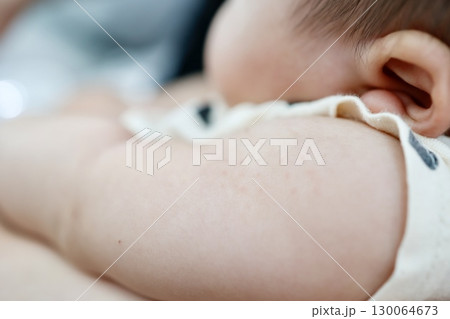 BCG予防接種から1ヶ月後の赤ちゃんの腕と注射跡 130064673